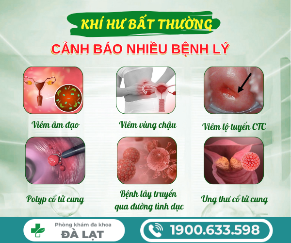 Hình ảnh minh họa